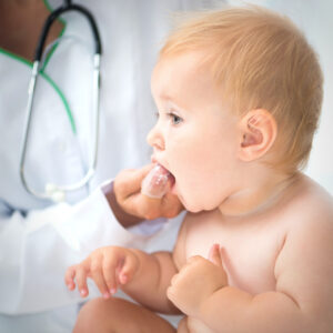 Frenotomy/Frenectomy Co-Visit